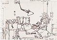 'After The Operation - Appendicitis, Middlesex Hospital' thumbnail